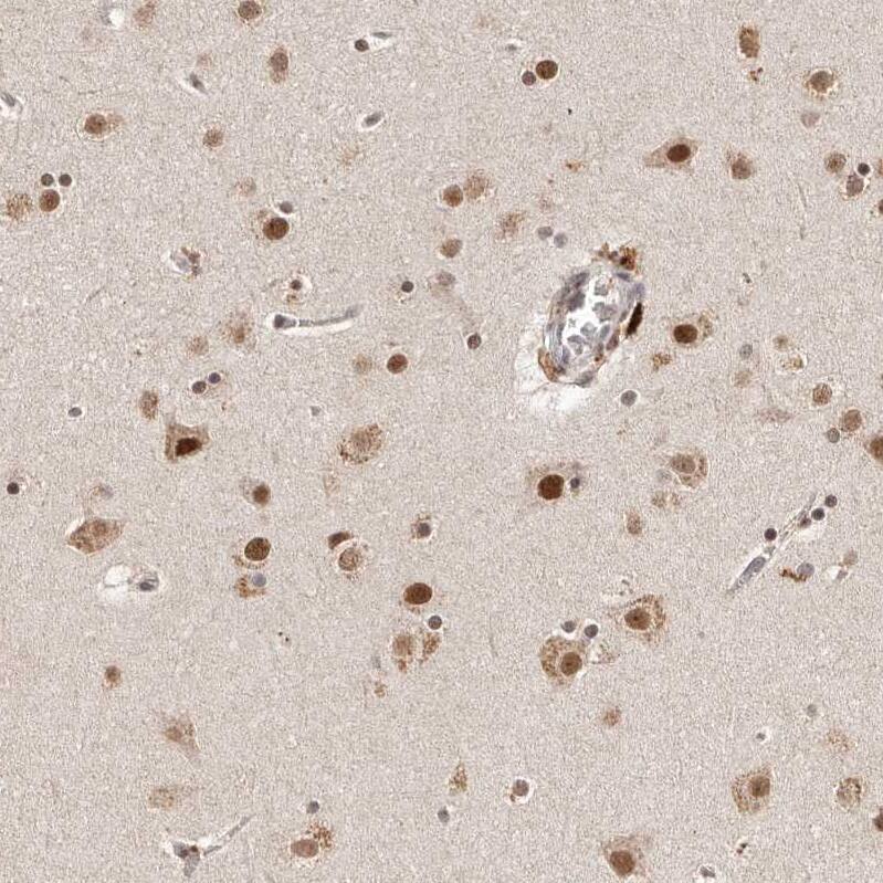 BICRAL Antibody - BSA Free Immunohistochemistry-Paraffin: BICRAL Antibody - BSA Free [NBP1-86359]