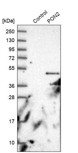 PON2 Antibody - BSA Free Western Blot: PON2 Antibody - BSA Free [NBP1-86365]