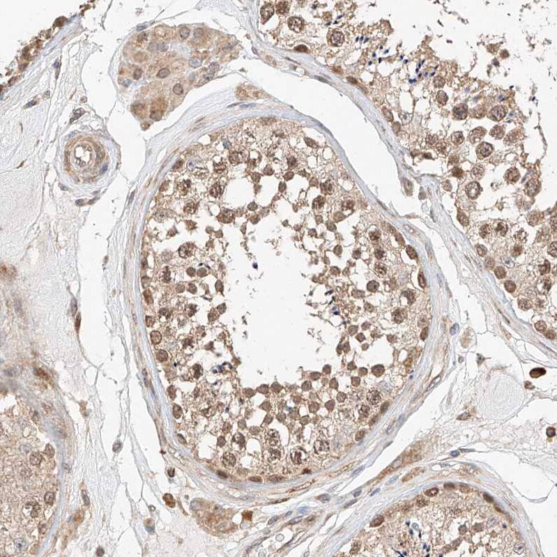 RAB23 Antibody - BSA Free Immunohistochemistry-Paraffin: RAB23 Antibody - BSA Free [NBP1-86366]