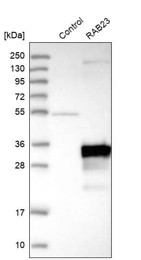 RAB23 Antibody - BSA Free Western Blot: RAB23 Antibody - BSA Free [NBP1-86366]