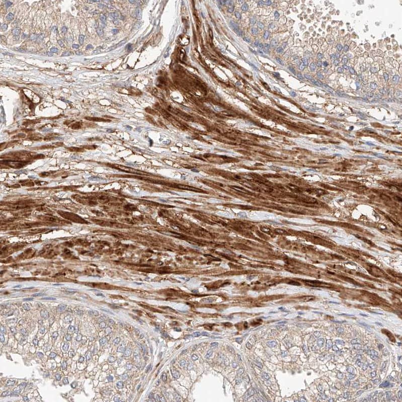 RAB23 Antibody - BSA Free Immunohistochemistry-Paraffin: RAB23 Antibody - BSA Free [NBP1-86366]