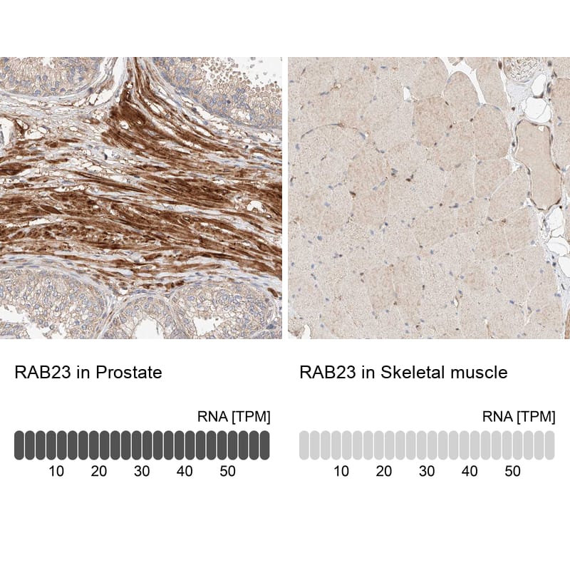 RAB23 Antibody - BSA Free Immunohistochemistry-Paraffin: RAB23 Antibody - BSA Free [NBP1-86366]
