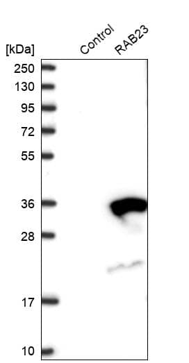 RAB23 Antibody - BSA Free Western Blot: RAB23 Antibody - BSA Free [NBP1-86367]