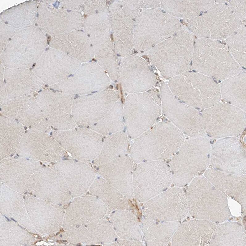 CSMD3 Antibody - BSA Free Immunohistochemistry-Paraffin: CSMD3 Antibody [NBP1-86371]