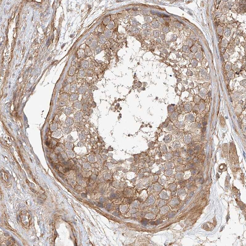 CSMD3 Antibody - BSA Free Immunohistochemistry-Paraffin: CSMD3 Antibody [NBP1-86371]