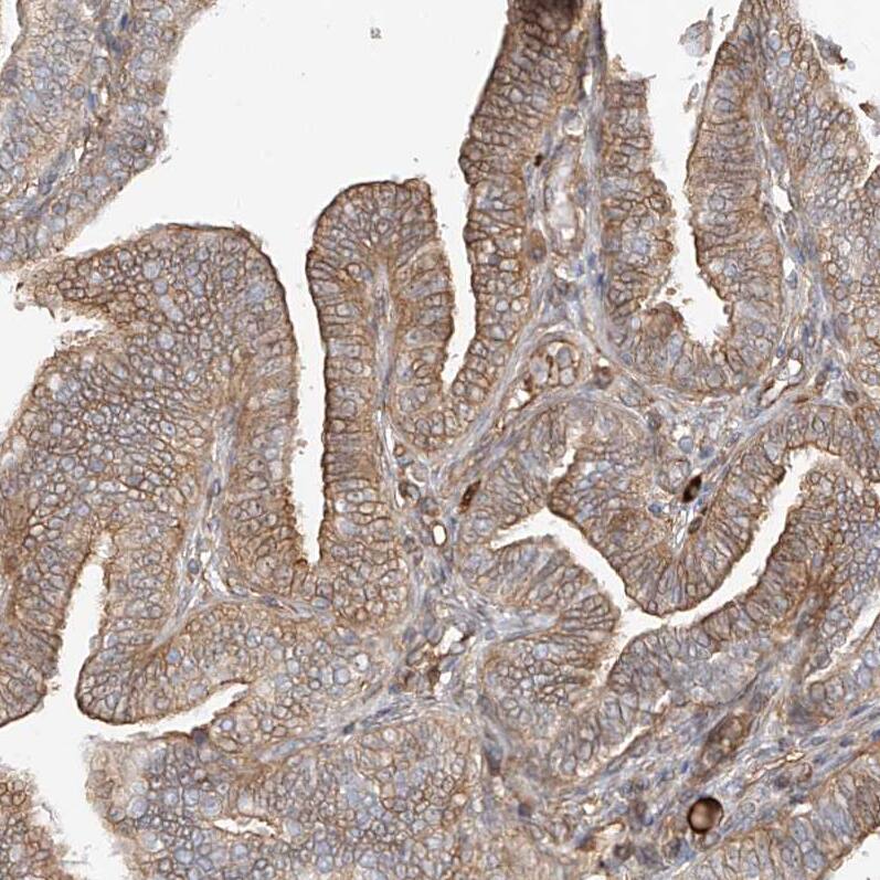 CSMD3 Antibody - BSA Free Immunohistochemistry-Paraffin: CSMD3 Antibody [NBP1-86371]