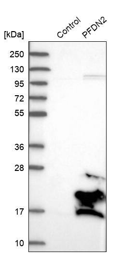 PFDN2 Antibody - BSA Free Western Blot: PFDN2 Antibody - BSA Free [NBP1-86378]