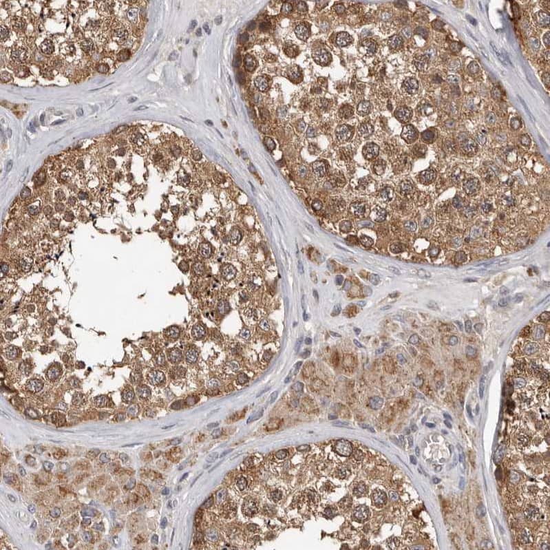 MTF1 Antibody - BSA Free Immunohistochemistry-Paraffin: MTF1 Antibody - BSA Free [NBP1-86379]