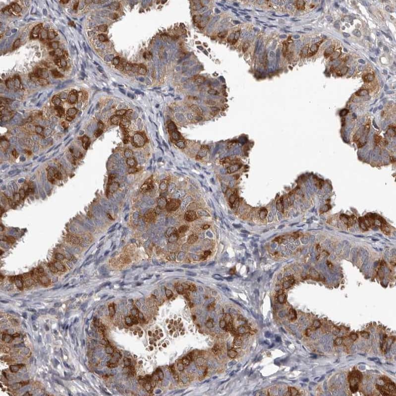 MTF1 Antibody - BSA Free Immunohistochemistry-Paraffin: MTF1 Antibody - BSA Free [NBP1-86379]