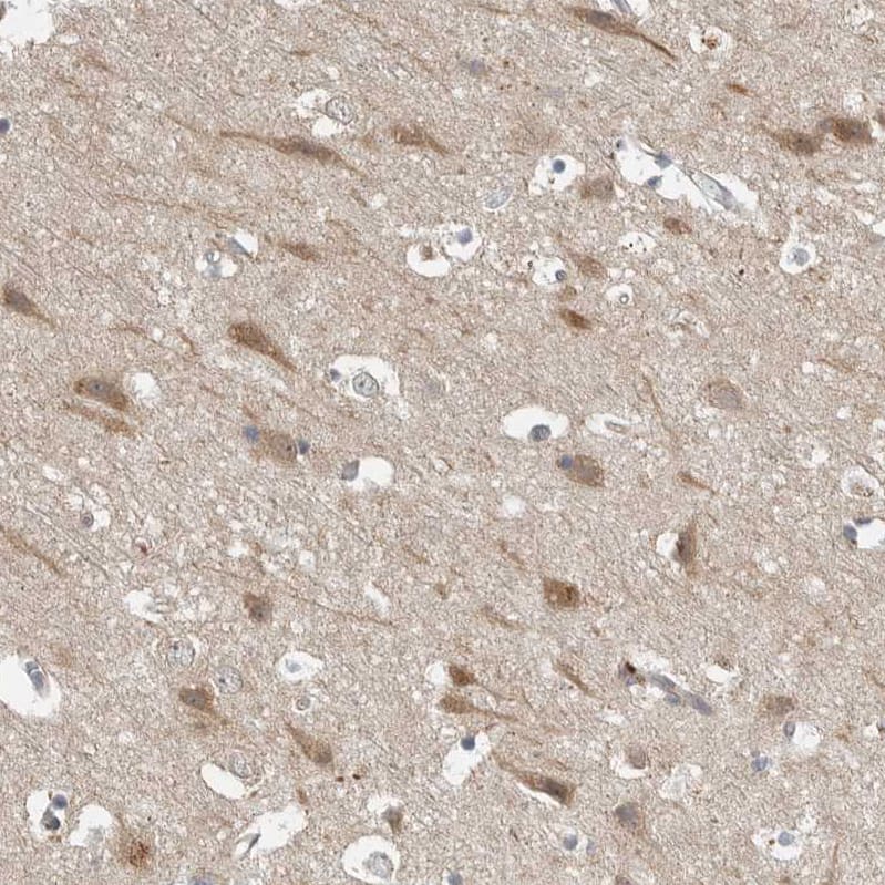 OSBPL9 Antibody - BSA Free Immunohistochemistry-Paraffin: OSBPL9 Antibody - BSA Free [NBP1-86390]