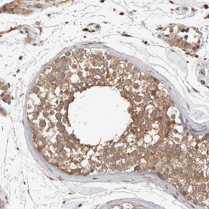 OSBPL9 Antibody - BSA Free Immunohistochemistry-Paraffin: OSBPL9 Antibody - BSA Free [NBP1-86390]