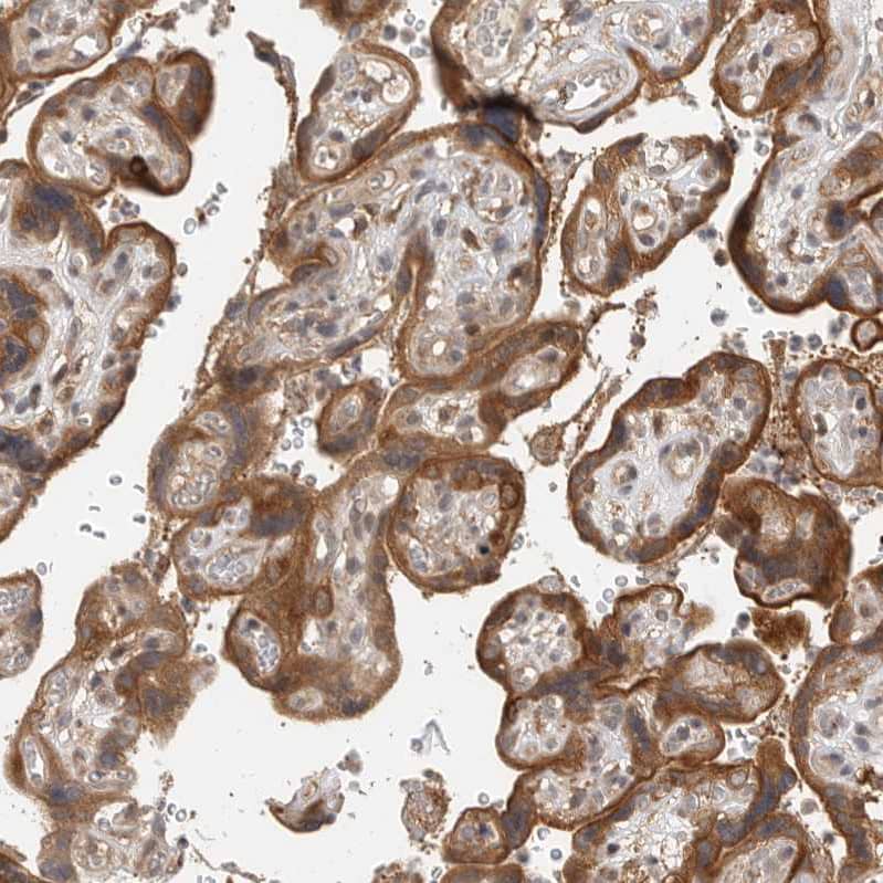 OSBPL9 Antibody - BSA Free Immunohistochemistry-Paraffin: OSBPL9 Antibody - BSA Free [NBP1-86390]