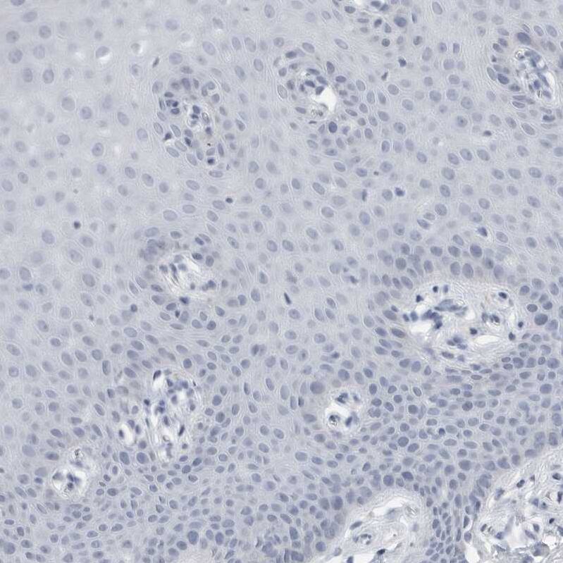 Tenascin R Antibody - BSA Free Immunohistochemistry-Paraffin: Tenascin R Antibody - BSA Free [NBP1-86399]