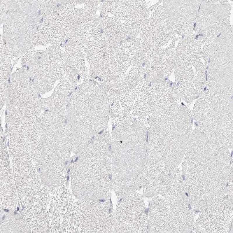 Tenascin R Antibody - BSA Free Immunohistochemistry-Paraffin: Tenascin R Antibody - BSA Free [NBP1-86399]