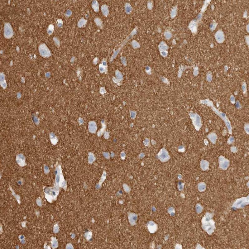 Tenascin R Antibody - BSA Free Immunohistochemistry-Paraffin: Tenascin R Antibody - BSA Free [NBP1-86399]