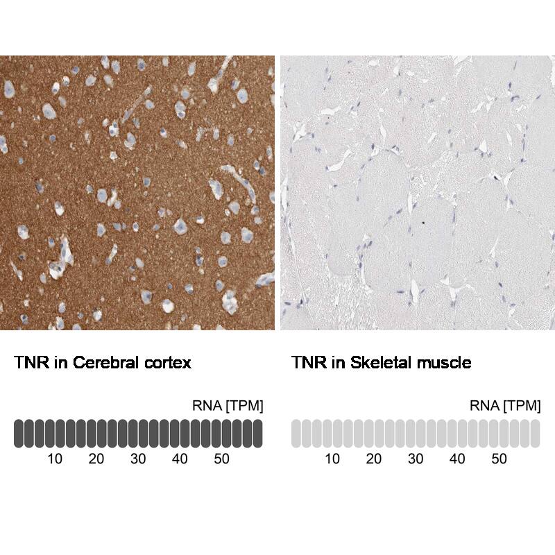 Tenascin R Antibody - BSA Free Immunohistochemistry-Paraffin: Tenascin R Antibody - BSA Free [NBP1-86399]