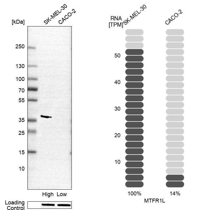 FAM54B Antibody - BSA Free Western Blot: FAM54B Antibody - BSA Free [NBP1-86401]