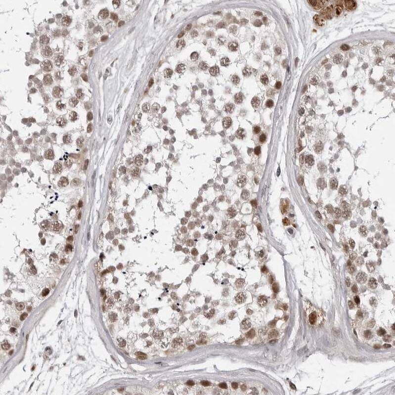 PHF3 Antibody - BSA Free Immunohistochemistry-Paraffin: PHF3 Antibody - BSA Free [NBP1-86407]