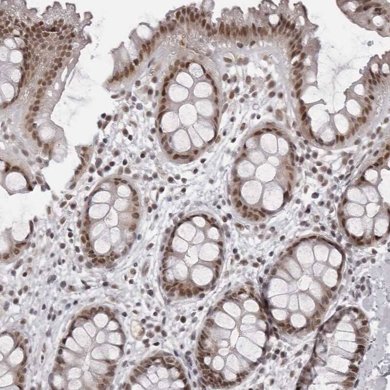 PHF3 Antibody - BSA Free Immunohistochemistry-Paraffin: PHF3 Antibody - BSA Free [NBP1-86407]