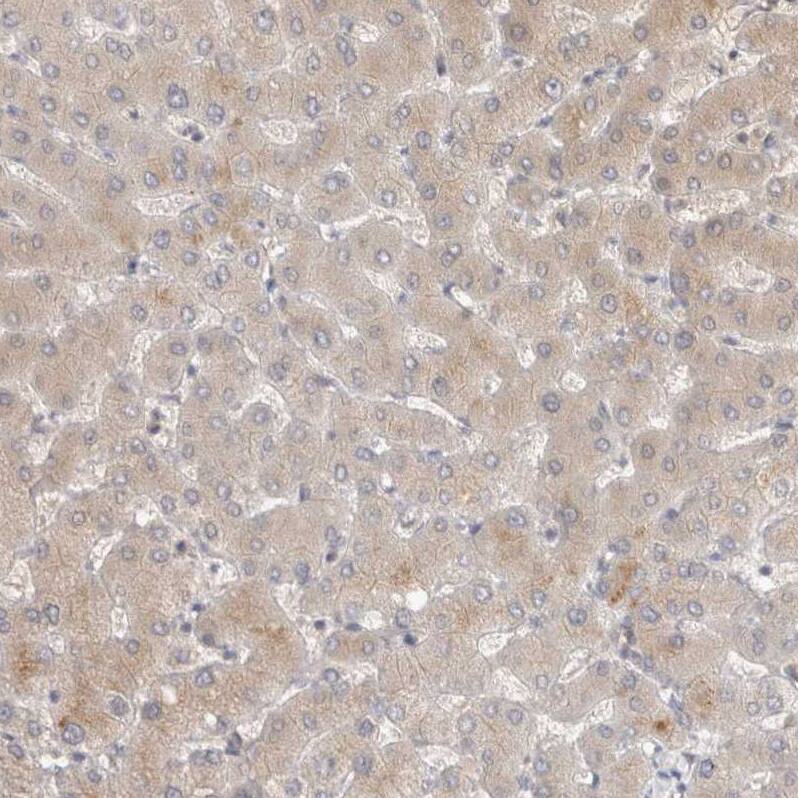 TOM1L2 Antibody - BSA Free Immunohistochemistry-Paraffin: TOM1L2 Antibody - BSA Free [NBP1-86414]
