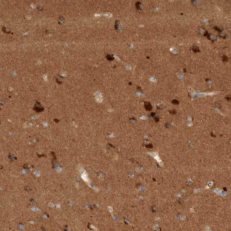 TOM1L2 Antibody - BSA Free Immunohistochemistry-Paraffin: TOM1L2 Antibody - BSA Free [NBP1-86414]