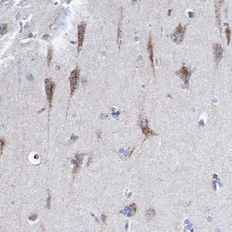 TRIM65 Antibody - BSA Free Immunohistochemistry-Paraffin: TRIM65 Antibody - BSA Free [NBP1-86423]