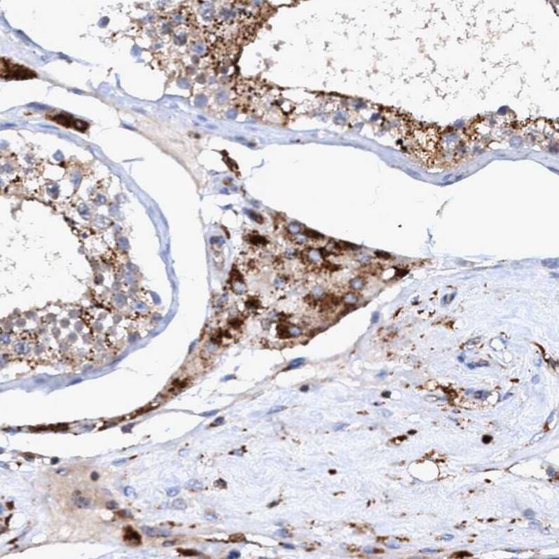 TRIM65 Antibody - BSA Free Immunohistochemistry-Paraffin: TRIM65 Antibody - BSA Free [NBP1-86423]
