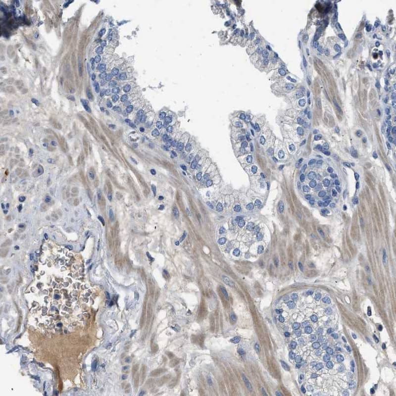 Complement Component C1s Antibody - BSA Free Immunohistochemistry-Paraffin: Complement Component C1s Antibody - BSA Free [NBP1-86439]