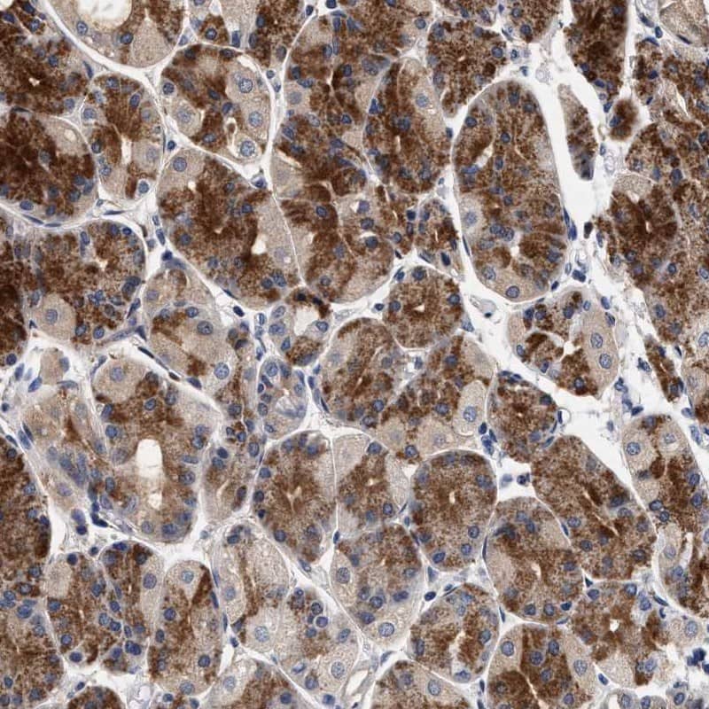 NEK7 Antibody - BSA Free Immunohistochemistry-Paraffin: NEK7 Antibody [NBP1-86444]