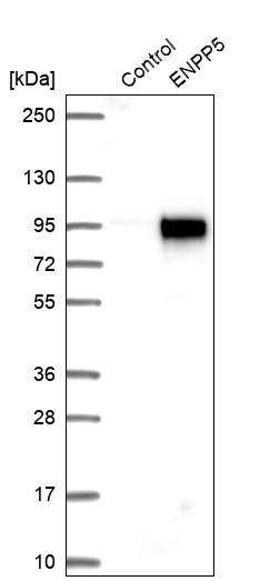 ENPP-5 Antibody - BSA Free Western Blot: ENPP-5 Antibody - BSA Free [NBP1-86449]