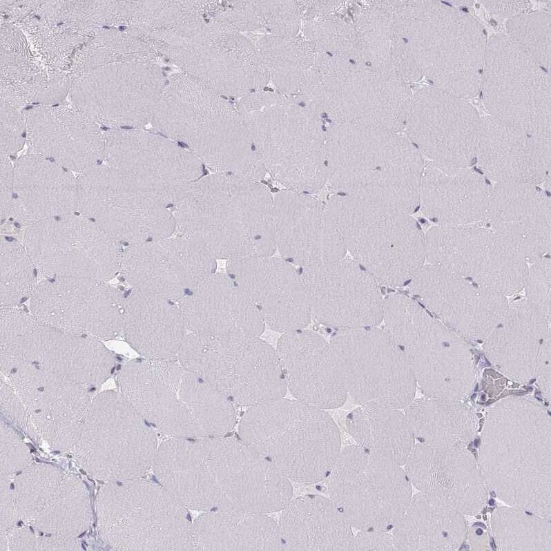 ZNF185 Antibody - BSA Free Immunohistochemistry-Paraffin: ZNF185 Antibody - BSA Free [NBP1-86452]
