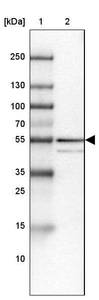 ZNF185 Antibody - BSA Free Western Blot: ZNF185 Antibody - BSA Free [NBP1-86452]