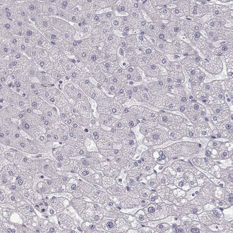 ZNF185 Antibody - BSA Free Immunohistochemistry-Paraffin: ZNF185 Antibody - BSA Free [NBP1-86452]