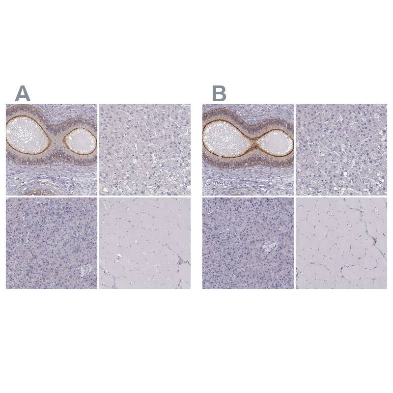 ZNF185 Antibody - BSA Free Immunohistochemistry-Paraffin: ZNF185 Antibody - BSA Free [NBP1-86452]