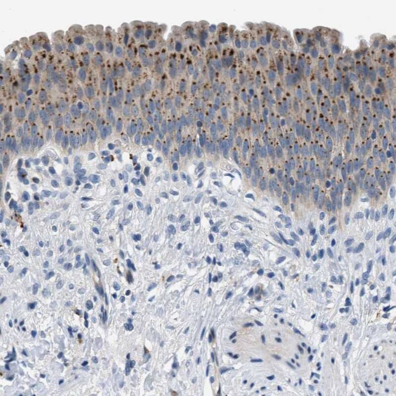 EMR3 Antibody - BSA Free Immunohistochemistry-Paraffin: EMR3 Antibody - BSA Free [NBP1-86454]