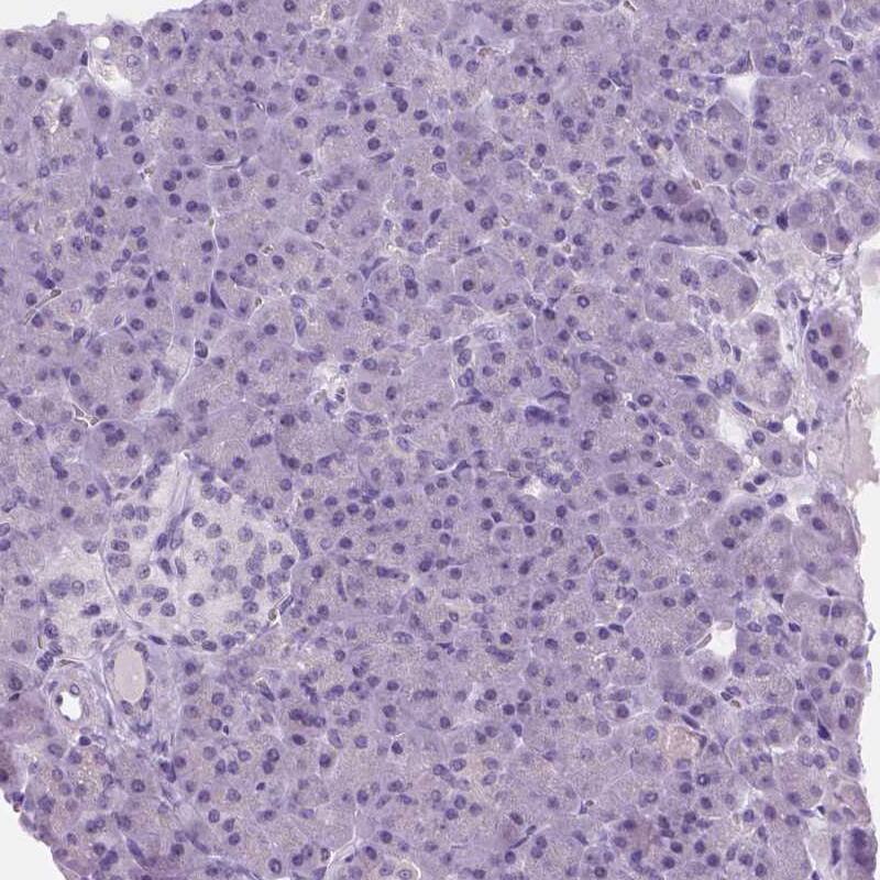 MYOM1 Antibody - BSA Free Immunohistochemistry-Paraffin: MYOM1 Antibody - BSA Free [NBP1-86460]
