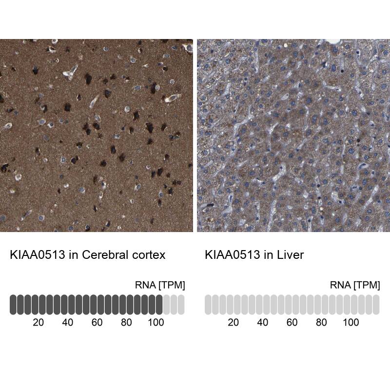 KIAA0513 Antibody - BSA Free Immunohistochemistry-Paraffin: KIAA0513 Antibody - BSA Free [NBP1-86470]