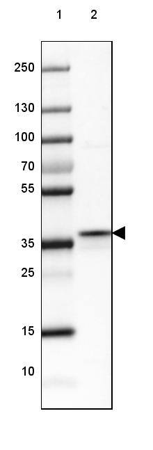 FBP2 Antibody - BSA Free Western Blot: FBP2 Antibody - BSA Free [NBP1-86473]
