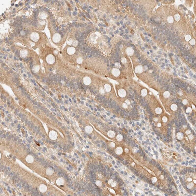 Tnk1 Antibody - BSA Free Immunohistochemistry-Paraffin: Tnk1 Antibody - BSA Free [NBP1-86477]
