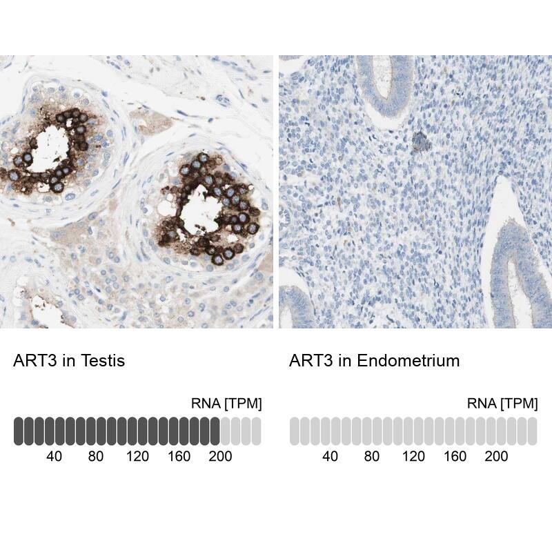ART3 Antibody - BSA Free Immunohistochemistry-Paraffin: ART3 Antibody - BSA Free [NBP1-86479]