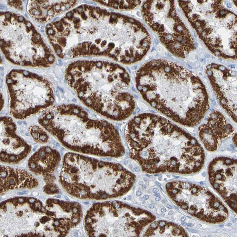ACMSD Antibody - BSA Free Immunohistochemistry-Paraffin: ACMSD Antibody - BSA Free [NBP1-86480]