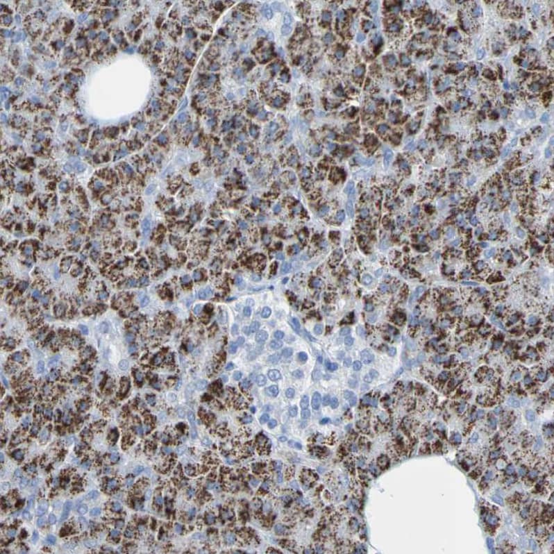 ACMSD Antibody - BSA Free Immunohistochemistry-Paraffin: ACMSD Antibody - BSA Free [NBP1-86480]