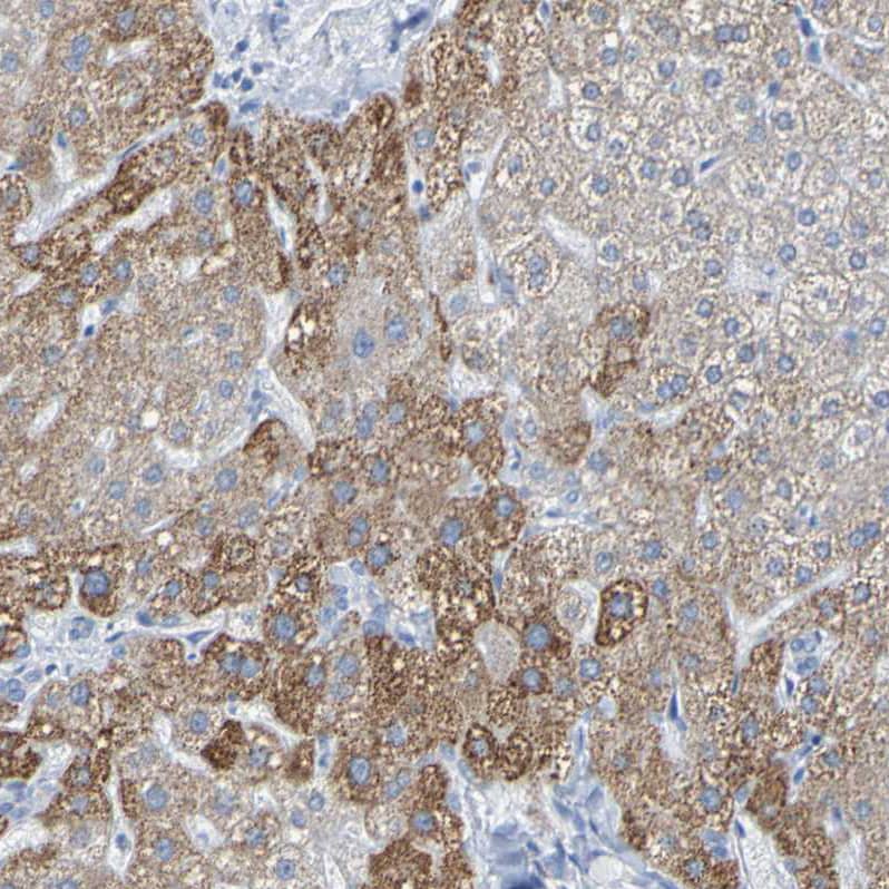 ACMSD Antibody - BSA Free Immunohistochemistry-Paraffin: ACMSD Antibody - BSA Free [NBP1-86480]