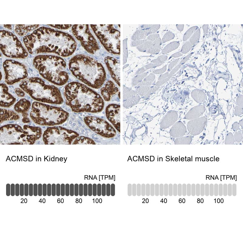 ACMSD Antibody - BSA Free Immunohistochemistry-Paraffin: ACMSD Antibody - BSA Free [NBP1-86480]