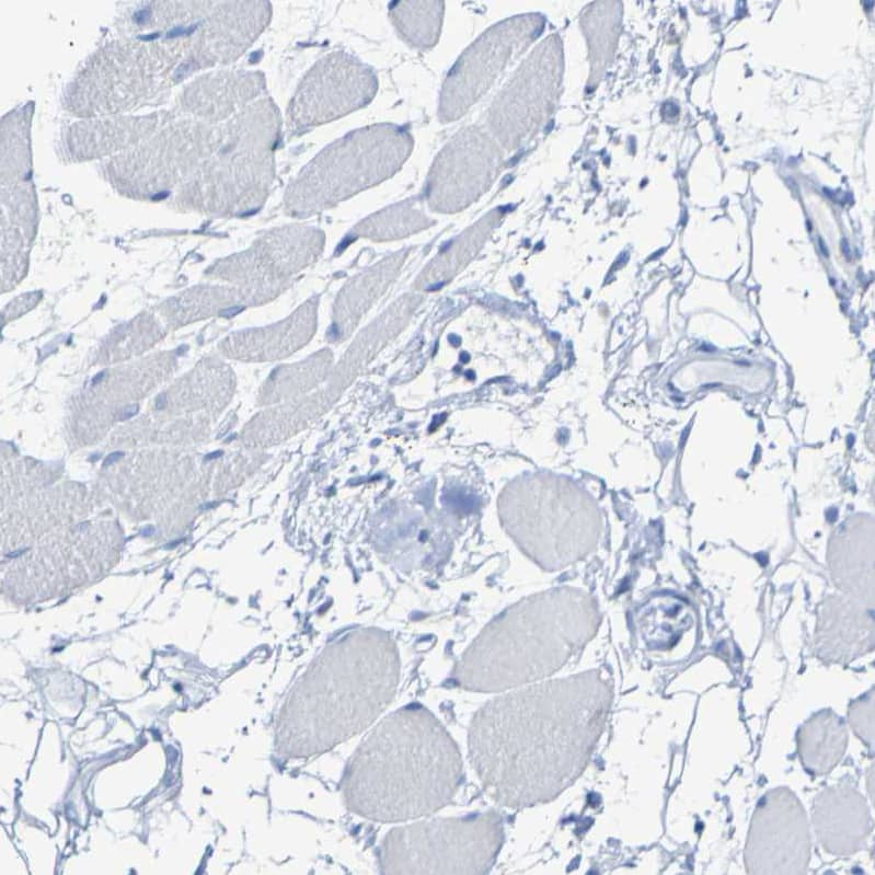 ACMSD Antibody - BSA Free Immunohistochemistry-Paraffin: ACMSD Antibody - BSA Free [NBP1-86480]