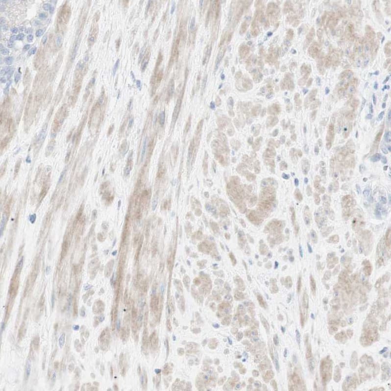 NDST4 Antibody - BSA Free Immunohistochemistry-Paraffin: NDST4 Antibody - BSA Free [NBP1-86481]