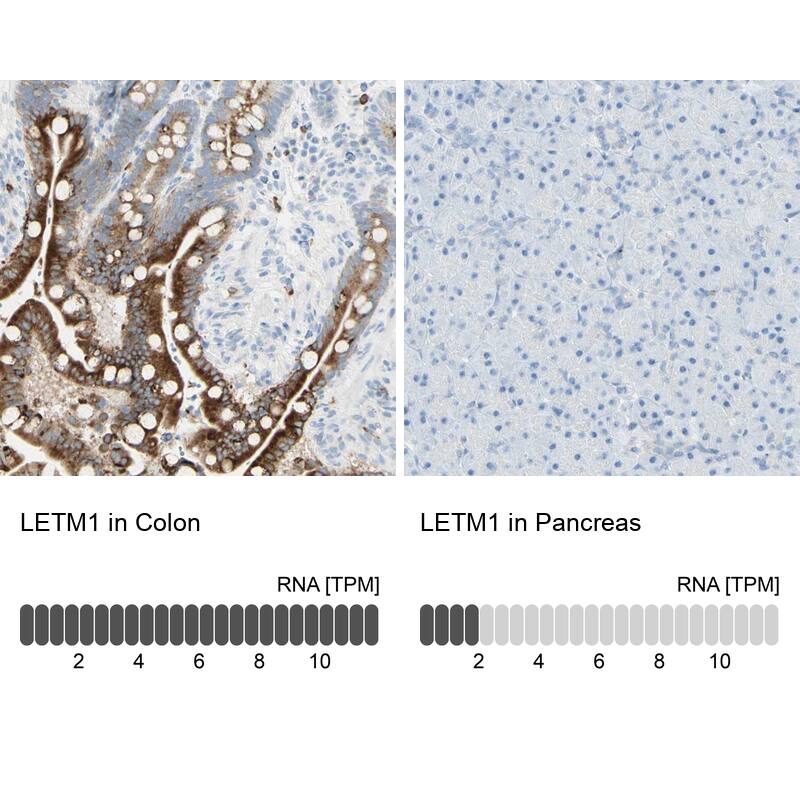 LETM1 Antibody - BSA Free Immunohistochemistry-Paraffin: LETM1 Antibody - BSA Free [NBP1-86482]