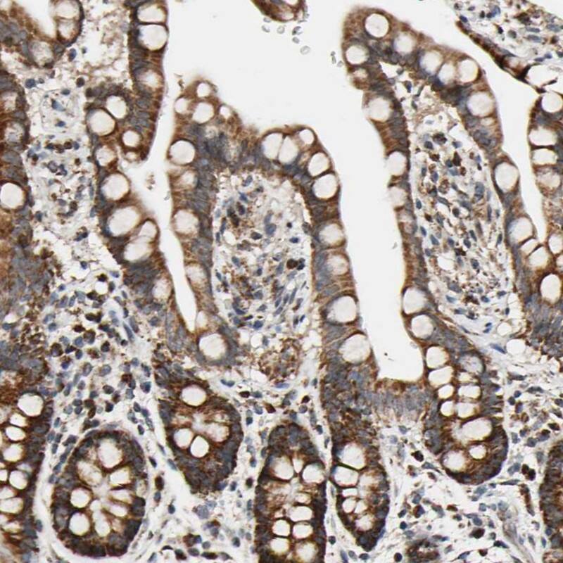 KHDC4 Antibody - BSA Free Immunohistochemistry-Paraffin: KHDC4 Antibody - BSA Free [NBP1-86485]