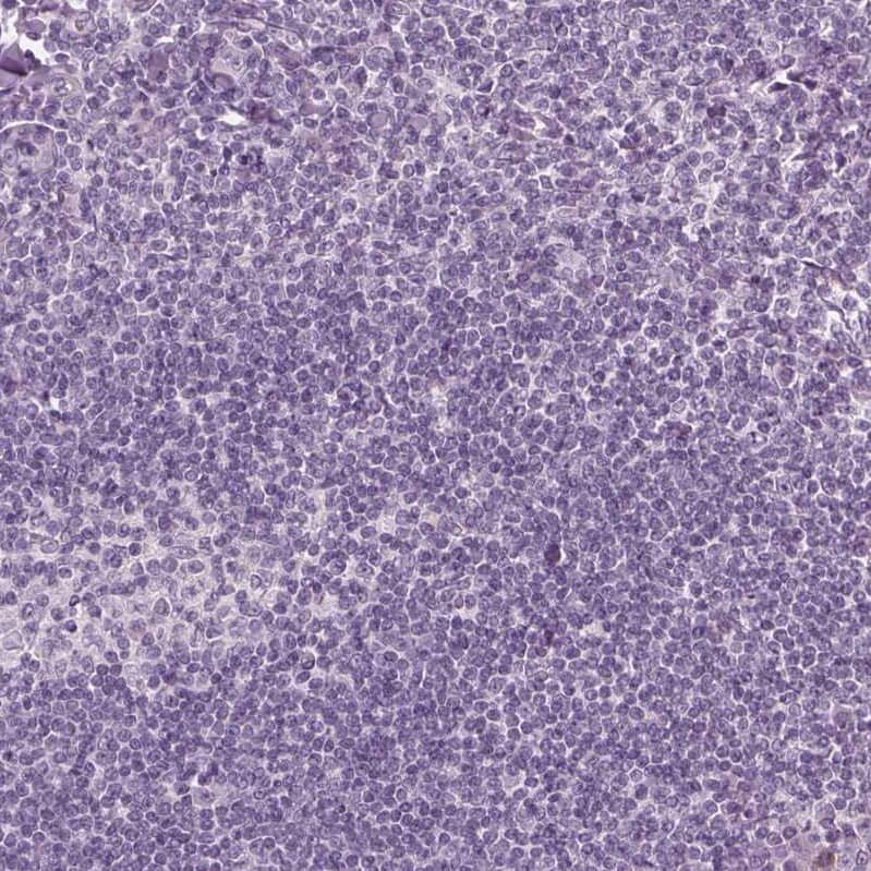 SLC6A17 Antibody - BSA Free Immunohistochemistry-Paraffin: SLC6A17 Antibody - BSA Free [NBP1-86494]