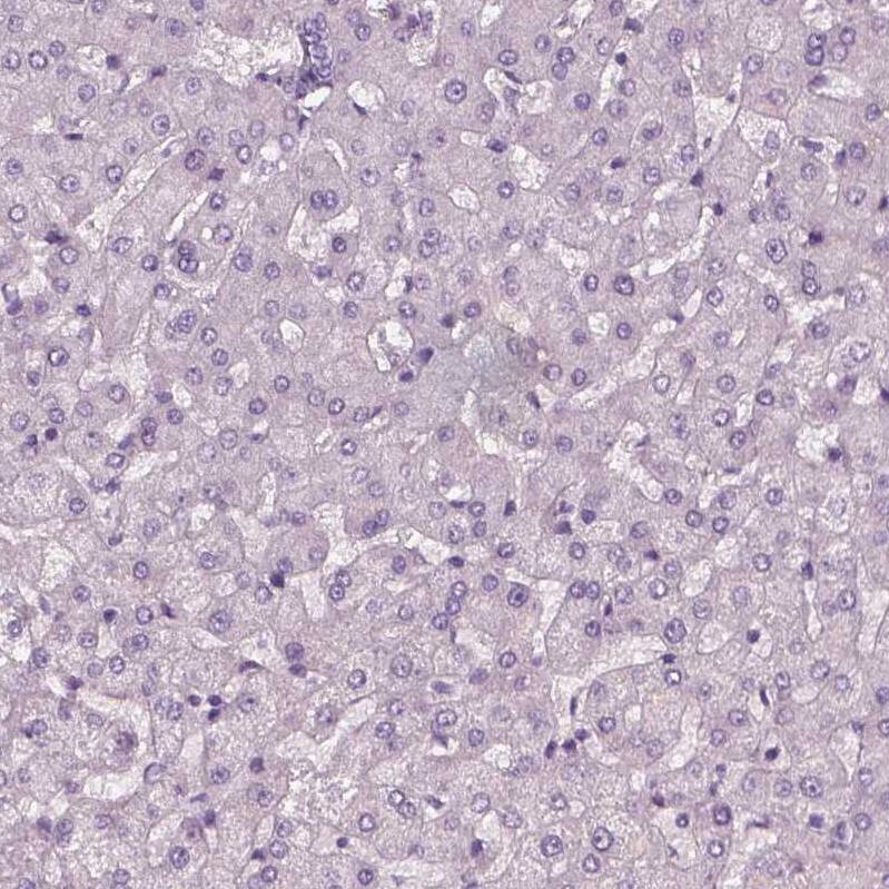 SLC6A17 Antibody - BSA Free Immunohistochemistry-Paraffin: SLC6A17 Antibody - BSA Free [NBP1-86494]